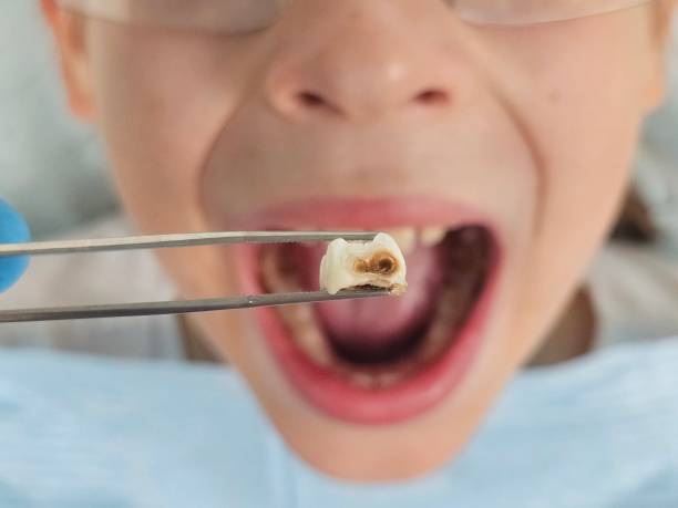 Best Emergency Denture Repair in Old Jamestown, MO